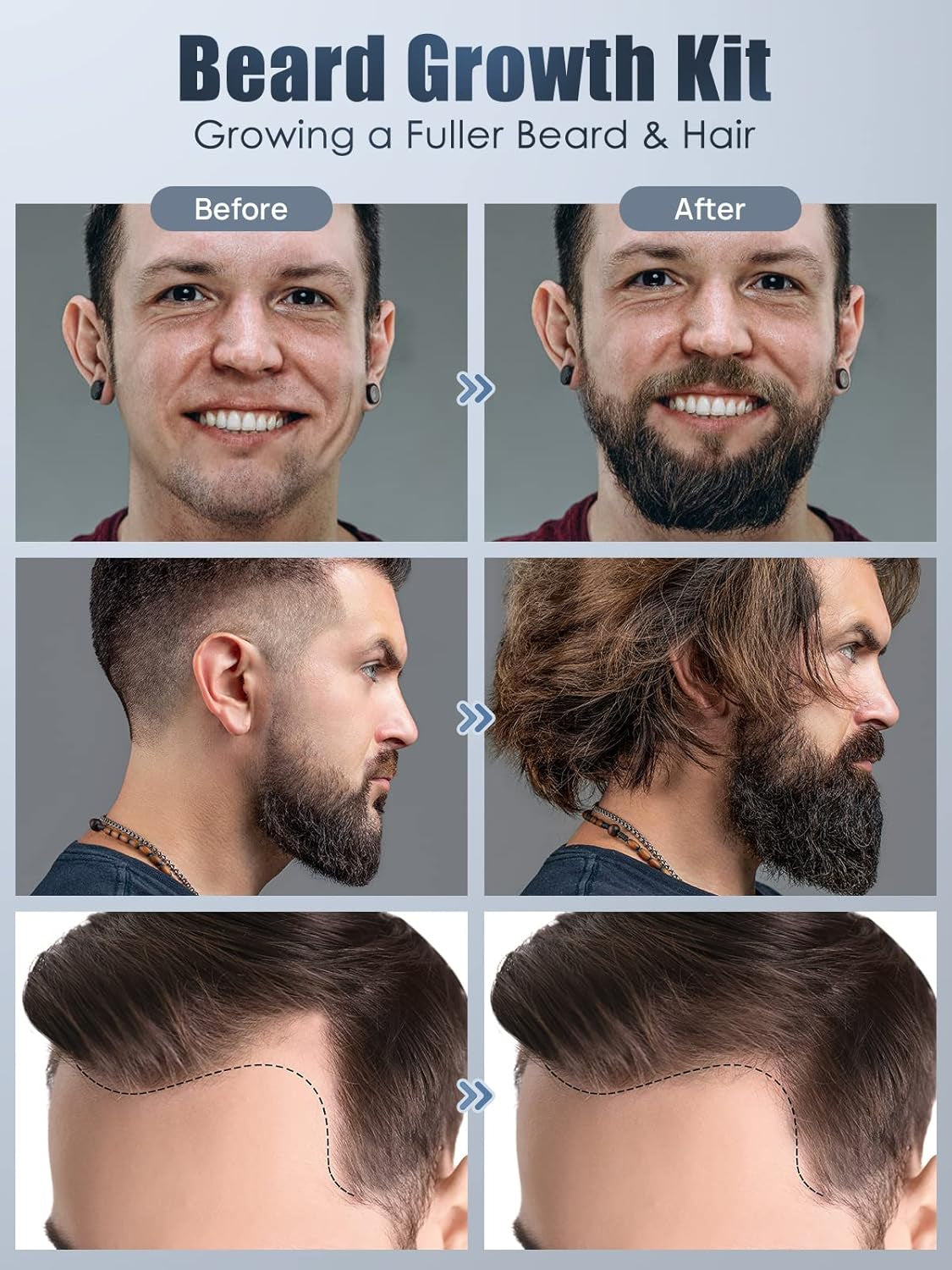 Beard Growth Kit, Oukzon Bart Wachstum Set - Bartwuchsmittel Männer Mit Bartroller 0,25Mm, Bartwuchs Bartöl, Bartbalsam, Bartschere, Bartwachstum Bartpflege Set, Vatertag Weihnachten Herren Geschenke