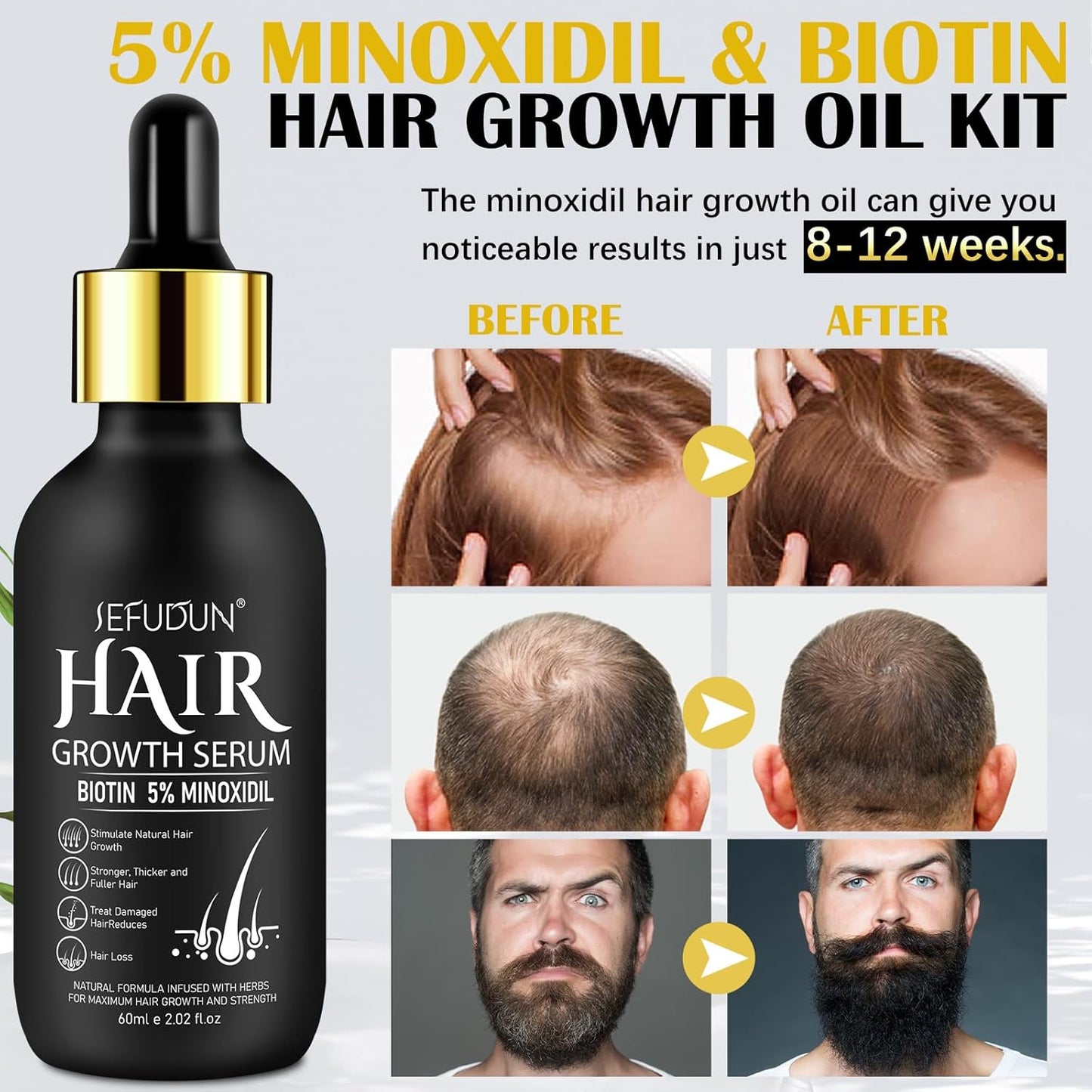 Bartwuchs Kit Mit Titanium Derma Roller, Beard Growth Kit,Bart Wachstum Set Mit Bartroller,Bartwuchs Bartöl Stimuliert Das Wachstum Von Haaren Und Bärten Für Weihnachten Herren Geschenke