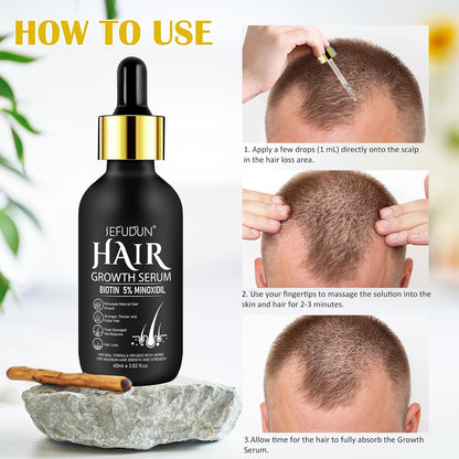Bartwuchs Kit Mit Titanium Derma Roller, Beard Growth Kit,Bart Wachstum Set Mit Bartroller,Bartwuchs Bartöl Stimuliert Das Wachstum Von Haaren Und Bärten Für Weihnachten Herren Geschenke