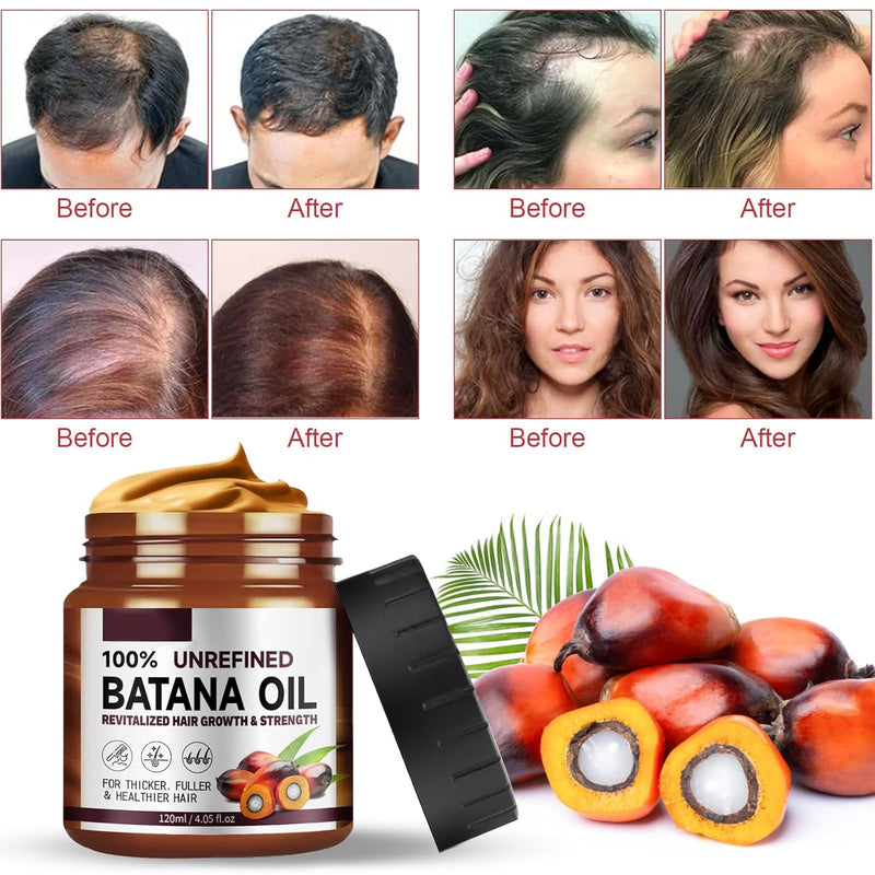 Bio Batana Öl Für Haarwachstum, 120 ML Organic Batana Oil Hair Growth Conditioner, Pure Raw Batana Oil Treatment, Verhindert Haarausfall, Repariert Beschädigtes Haar
